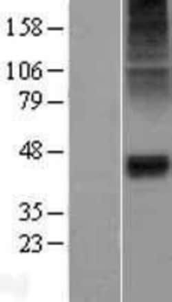 Novus Biologicals&trade;&nbsp;Glycine Receptor Alpha 1 Overexpression Lysate