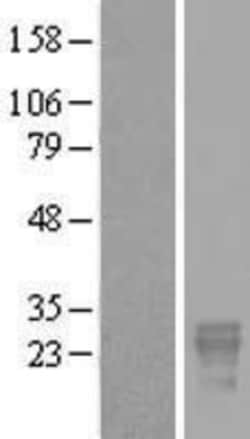Novus Biologicals™ PP14/Glycodelin Overexpression Lysate