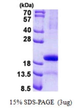 Novus Biologicals&trade;&nbsp;Recombinant Human PP14/Glycodelin His Protein