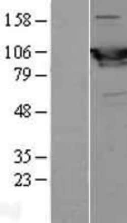 Novus Biologicals&trade;&nbsp;Glycogen phosphorylase, muscle form Overexpression Lysate