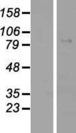 Novus Biologicals&trade;&nbsp;Glycogen synthase 2 Overexpression Lysate