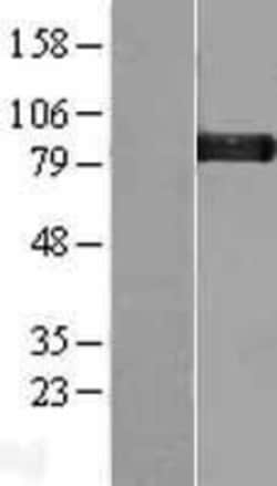 Novus Biologicals&trade;&nbsp;Glycogen Synthase Overexpression Lysate