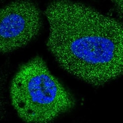 Glycogen Phosphorylase BB/GPBB Antibody, Novus Biologicals 0.1mL; Unlabeled:Antibodies,