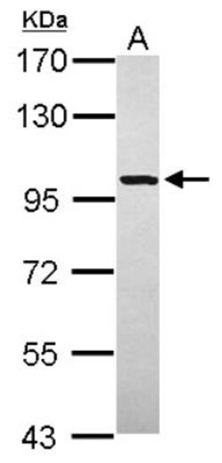 Glycogen phosphorylase, muscle form Antibody, Novus Biologicals 0.1mL;