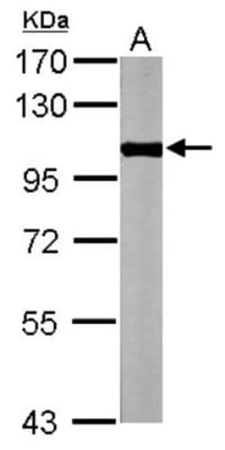 Glycogen phosphorylase, muscle form Antibody, Novus Biologicals 0.1mL;