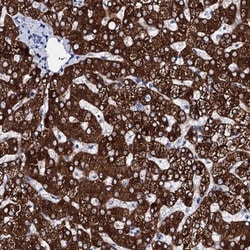 Glycogen synthase 2 Antibody, Novus Biologicals 0.1mL; Unlabeled:Antibodies,
