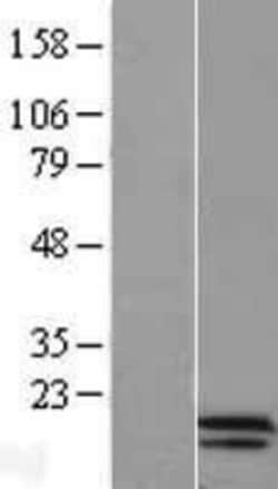 Novus Biologicals&trade;&nbsp;Chorionic Gonadotropin alpha Chain (hCG alpha) Overexpression Lysate