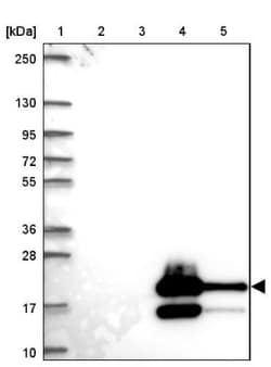Glycosyltransferase-Like 1B Antibody, Novus Biologicals:Antibodies:Primary