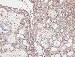 GLYCTK Antibody, Novus Biologicals 0.1mL; Unlabeled:Antibodies, Polyclonal