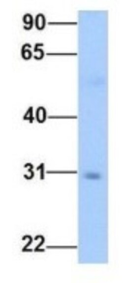 Glyoxalase II/HAGH Antibody, Novus Biologicals 100 &mu;L | Buy Online | Novus Biologicals | Fisher Scientific