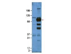 Glypican 1 Antibody, Novus Biologicals 0.1mg; Unlabeled:Antibodies, Polyclonal