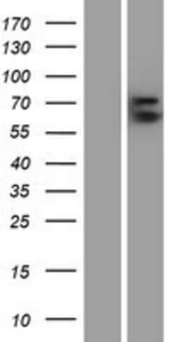 Novus Biologicals&trade;&nbsp;Glypican 3 Overexpression Lysate
