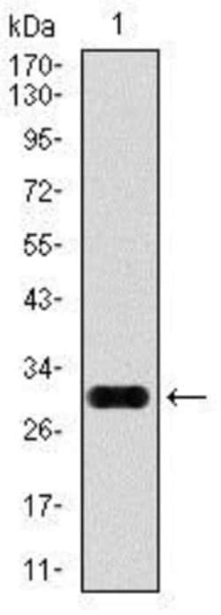 Glypican 3 Antibody (9C2) - BSA Free, Novus Biologicals 0.1mL; Unlabeled:Antibodies,