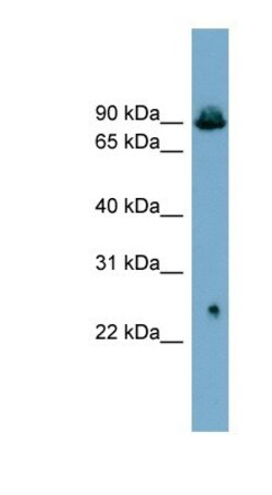 GlyT2/SLC6A5 Antibody, Novus Biologicals 0.05mg; Unlabeled:Antibodies,