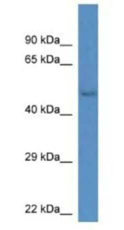 Gm13178 Antibody, Novus Biologicals:Antibodies:Primary Antibodies