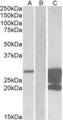 GM2A Antibody, Novus Biologicals 0.1 mg | Buy Online | Novus Biologicals | Fisher Scientific