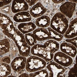 GM2A Antibody, Novus Biologicals 25 &mu;L; Unlabeled:Antibodies, Polyclonal