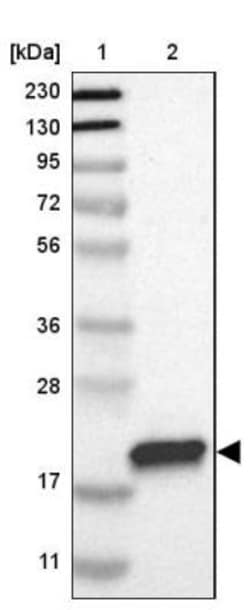 GM2A Antibody, Novus Biologicals 25 &mu;L; Unlabeled:Antibodies, Polyclonal