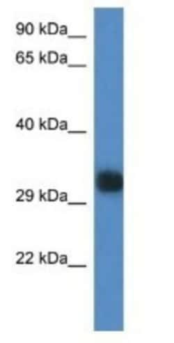 Gm527 Antibody, Novus Biologicals:Antibodies:Primary Antibodies