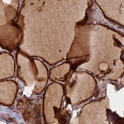 GMCL1 Antibody, Novus Biologicals 25 &mu;L | Buy Online | Novus Biologicals | Fisher Scientific