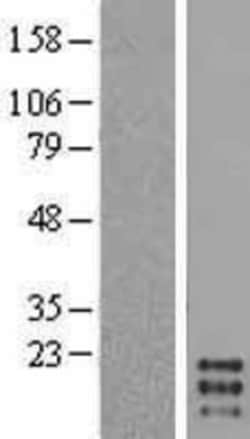 Novus Biologicals&trade;&nbsp;GM-CSF Overexpression Lysate