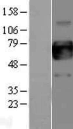 Novus Biologicals&trade;&nbsp;GM-CSFR alpha Overexpression Lysate