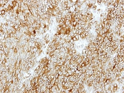 GMDS Antibody, Novus Biologicals 0.1mg; Unlabeled:Antibodies, Polyclonal