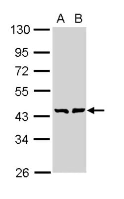 GMDS Antibody, Novus Biologicals 0.1mg; Unlabeled:Antibodies, Polyclonal