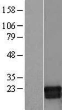 Novus Biologicals&trade;&nbsp;GMF-beta Overexpression Lysate