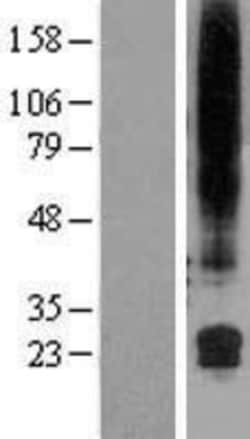 Novus Biologicals&trade;&nbsp;GML Overexpression Lysate