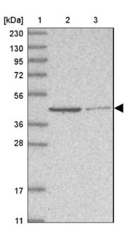 GMPPA Antibody, Novus Biologicals 0.1mL; Unlabeled:Antibodies, Polyclonal