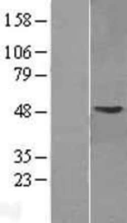 Novus Biologicals&trade;&nbsp;GMPPA Overexpression Lysate