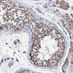 GMPR1 Antibody, Novus Biologicals:Antibodies:Primary Antibodies