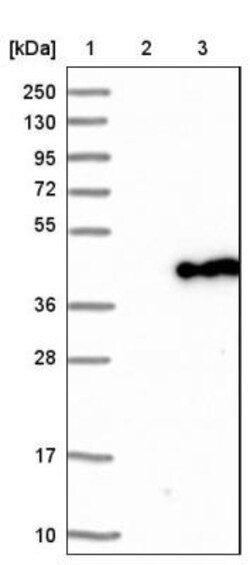 GMPR1 Antibody, Novus Biologicals:Antibodies:Primary Antibodies