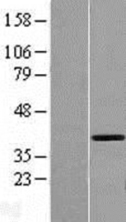 Novus Biologicals&trade;&nbsp;GMPR2 Overexpression Lysate