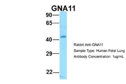 GNA11 Antibody, Novus Biologicals 100&mu;L; Unlabeled:Antibodies, Polyclonal
