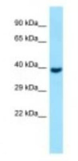 GNA11 Antibody, Novus Biologicals 100&mu;L; Unlabeled:Antibodies, Polyclonal