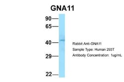 GNA11 Antibody, Novus Biologicals 100&mu;L; Unlabeled:Antibodies, Polyclonal