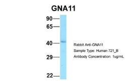 GNA11 Antibody, Novus Biologicals 100&mu;L; Unlabeled:Antibodies, Polyclonal
