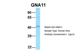 GNA11 Antibody, Novus Biologicals 100&mu;L; Unlabeled:Antibodies, Polyclonal