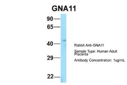 GNA11 Antibody, Novus Biologicals 100&mu;L; Unlabeled:Antibodies, Polyclonal