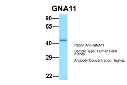 GNA11 Antibody, Novus Biologicals 100&mu;L; Unlabeled:Antibodies, Polyclonal