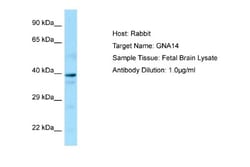 GNA14 Antibody, Novus Biologicals 100&mu;L; Unlabeled:Antibodies, Polyclonal