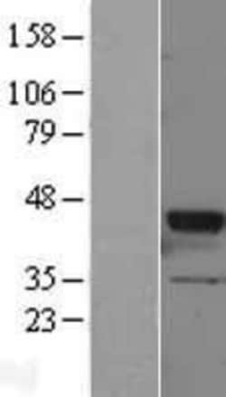 Novus Biologicals&trade;&nbsp;GNAT2 Overexpression Lysate