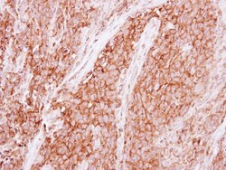 GNB1 Antibody, Novus Biologicals 0.1mL; Unlabeled:Antibodies, Polyclonal