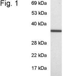 GNB1 Antibody, Novus Biologicals 100 &mu;g | Buy Online | Novus Biologicals | Fisher Scientific
