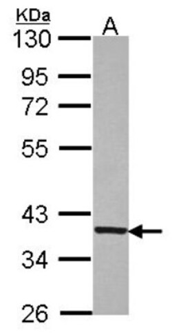 GNB1 Antibody, Novus Biologicals 0.1mL; Unlabeled:Antibodies, Polyclonal