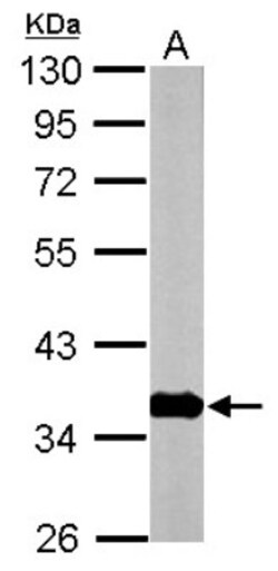 GNB1 Antibody, Novus Biologicals 0.1mL; Unlabeled:Antibodies, Polyclonal