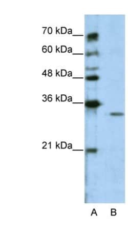GNB1L Antibody, Novus Biologicals:Antibodies:Primary Antibodies