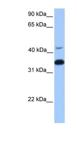GNB2 Antibody, Novus Biologicals 100 &mu;L | Buy Online | Novus Biologicals | Fisher Scientific
